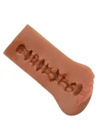 Bezhraničná vulva — obrázok 15